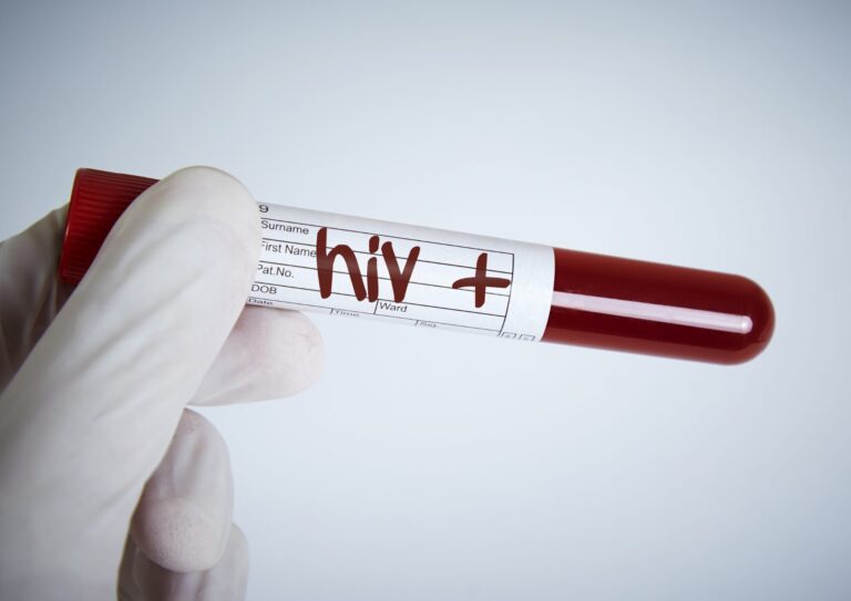 【恵比寿】HIV検査ならモイストクリニック｜即日検査対応・夜22時まで