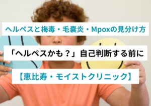 ヘルペスと梅毒・毛嚢炎・Mpoxの見分け方（鑑別ガイド）｜恵比寿モイストクリニック